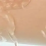 تضميد رغوة السيليكون، رقعة تضميد الجروح المقاومة للماء لقرحة الضغط، رقعة معقمة لرحلة الضغط الفردية #1