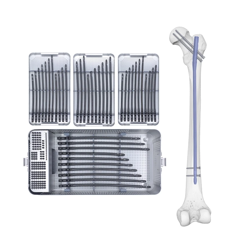 Expert Femoral Interlocking Nail Box Orthopedic Titanium Implant Pedicle Screw Medical Supply Implant Interventional Materials