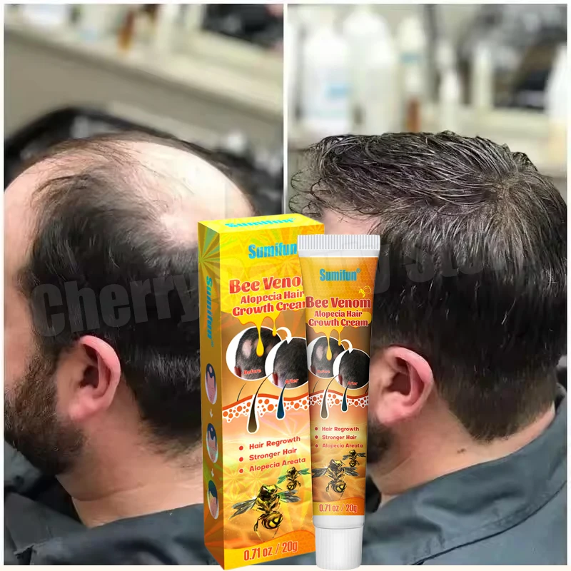 

7-дневный крем для быстрого роста волос, средство против выпадения волос, восстановление, питание, поврежденные волосы, уход за кожей головы для женщин и мужчин, товары