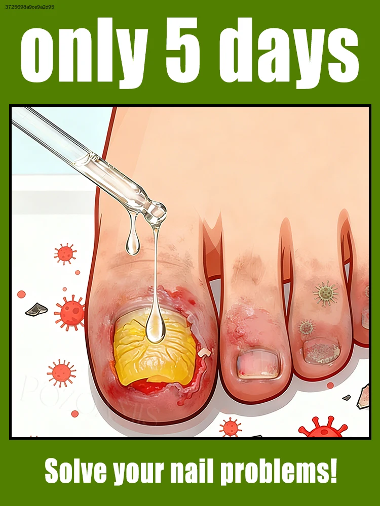 

Eɴᴅ ᴅʀʏ ᴄᴜᴛɪᴄʟᴇs, ᴋᴇᴇᴘ ғɪɴɢᴇʀᴛɪᴘs sᴜᴘᴘʟᴇ ᴀɴᴅ ᴡᴇʟʟ-ɴᴏᴜʀɪsʜᴇᴅ.