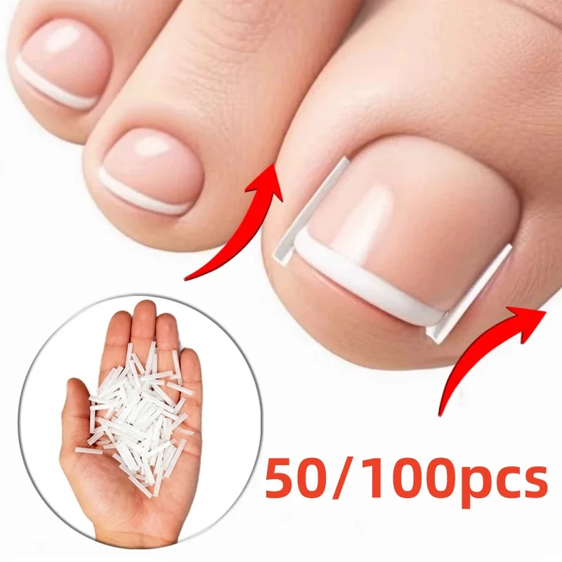 50/100PC 陥入爪矯正ツール陥入爪治療弾性パッチステッカー矯正クリップブレースペディキュアツール