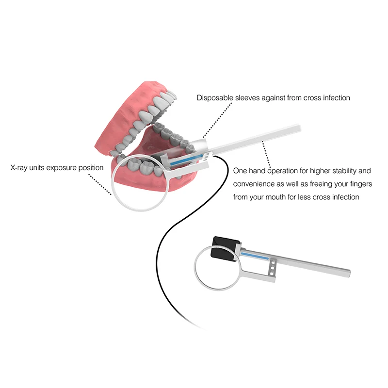 VVDental Sensor X-Ray Draagbare Hoogfrequente Rx Digitale Intraorale lmaging Systeem HD Beeld Radiovisografo Tandheelkundige Digitale Sensor