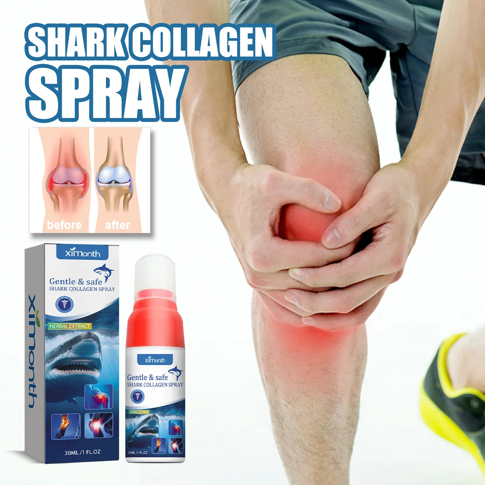 30ml Anti Pain Ointment Knee Relief Spray Relieve Knee Arthritis Soothes Health Treatment Pain Joint Care Body Foot 무지외반증교정기