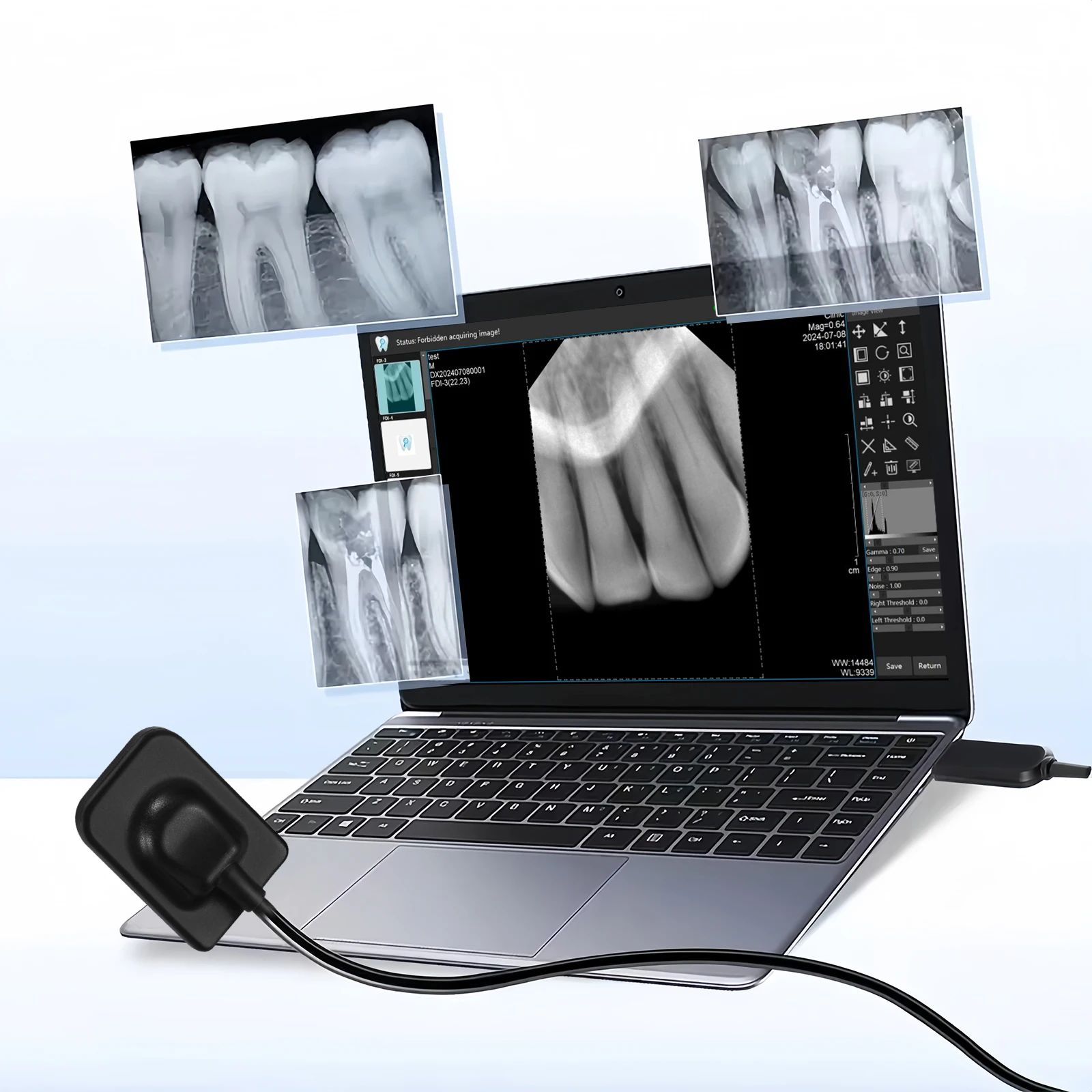 Dental X ray Sensor Digital Sensor Rayos Digital Imaging System Sensor w/ Holder