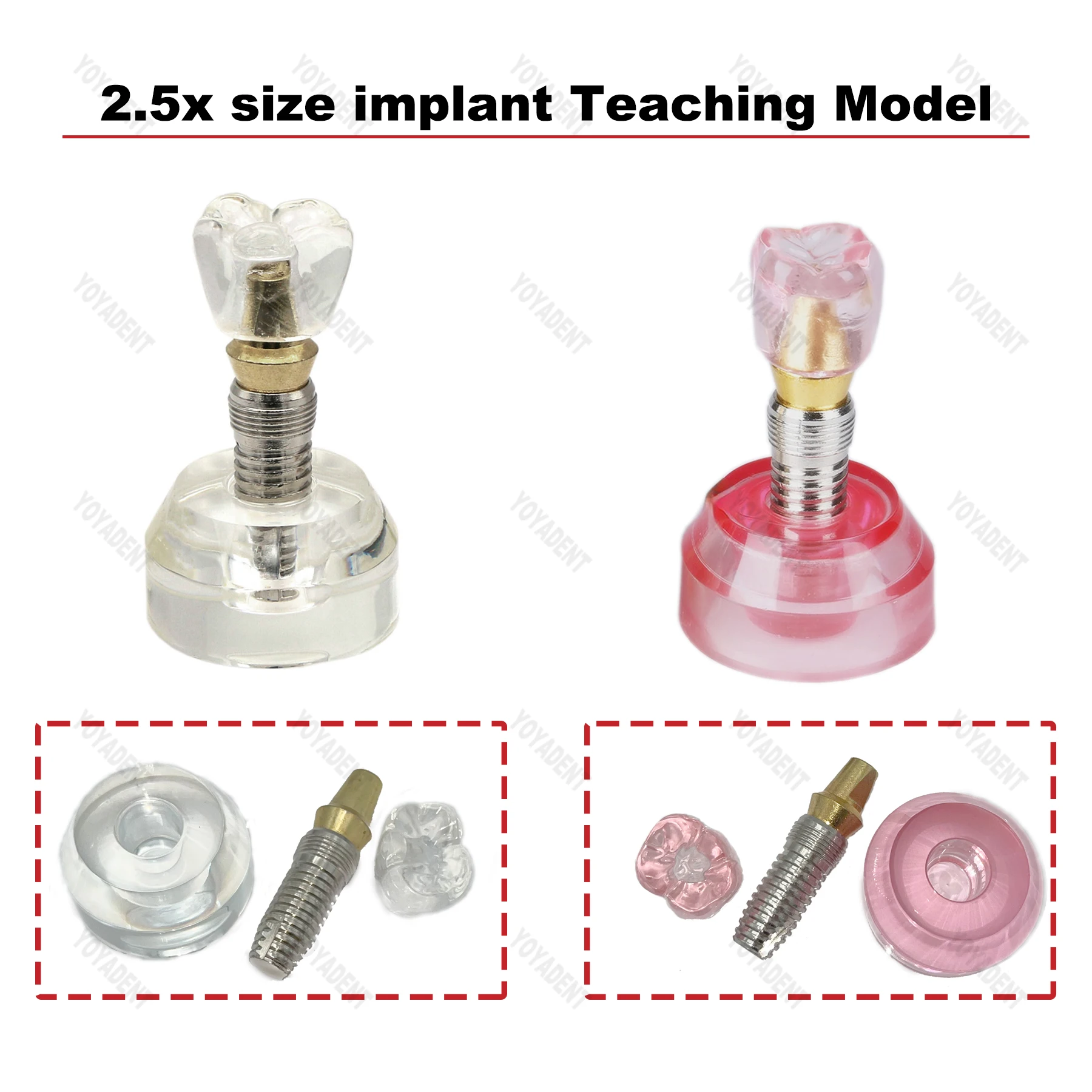 

Dental Teeth Model Resins Model Typodont Implant Teaching Teeth Models For Dentist Patient Communication Demo 2.5x size