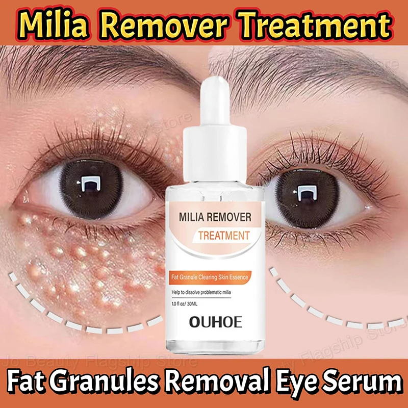 Fat Granules Removal Eye Serum Eye Milia Repair Treatment Products Wrinkle Lifting Moisturizing Anti-Puffiness Korean Skin Care