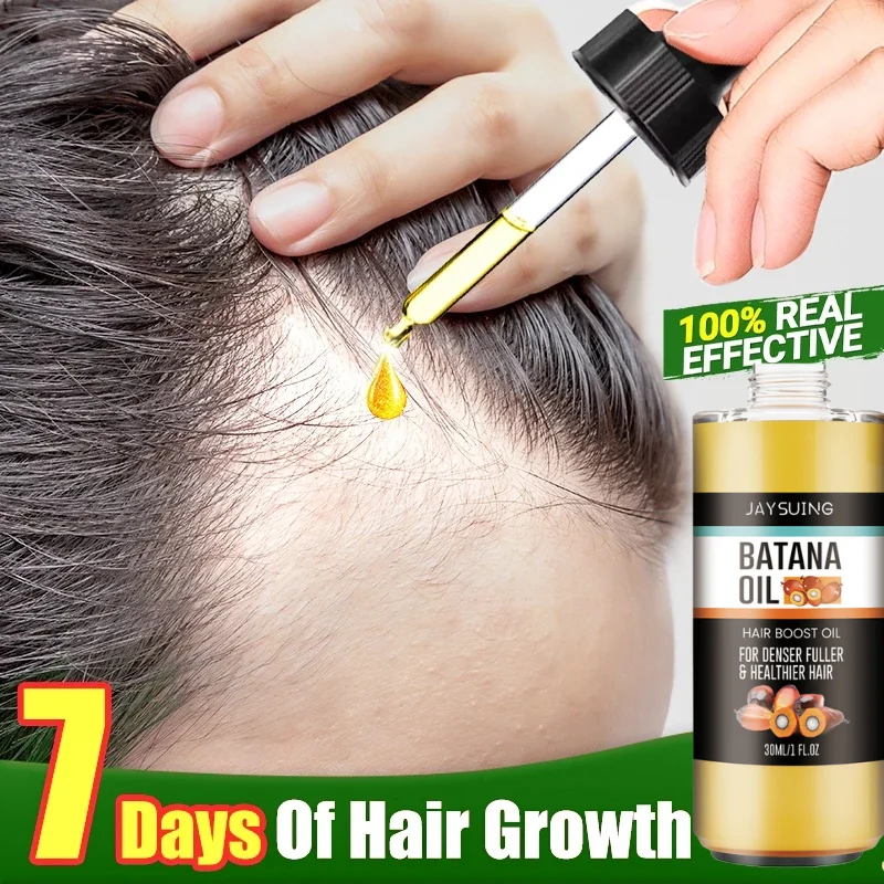 

Hair Growth Set Batana Oil Traction Alopecia Hair Mask Anti Break Loss Hair Growth Oil Baldness Treatment Hair Health Care