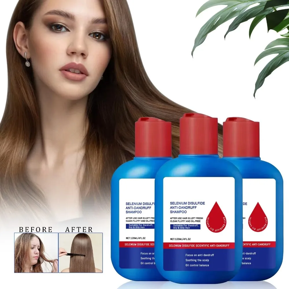 

New 120ml Nipori Shampoo Oil Control Anti-Dandruff Selenium Sulfide Shampoo Refreshing Cleansing Shampoo Hair Care