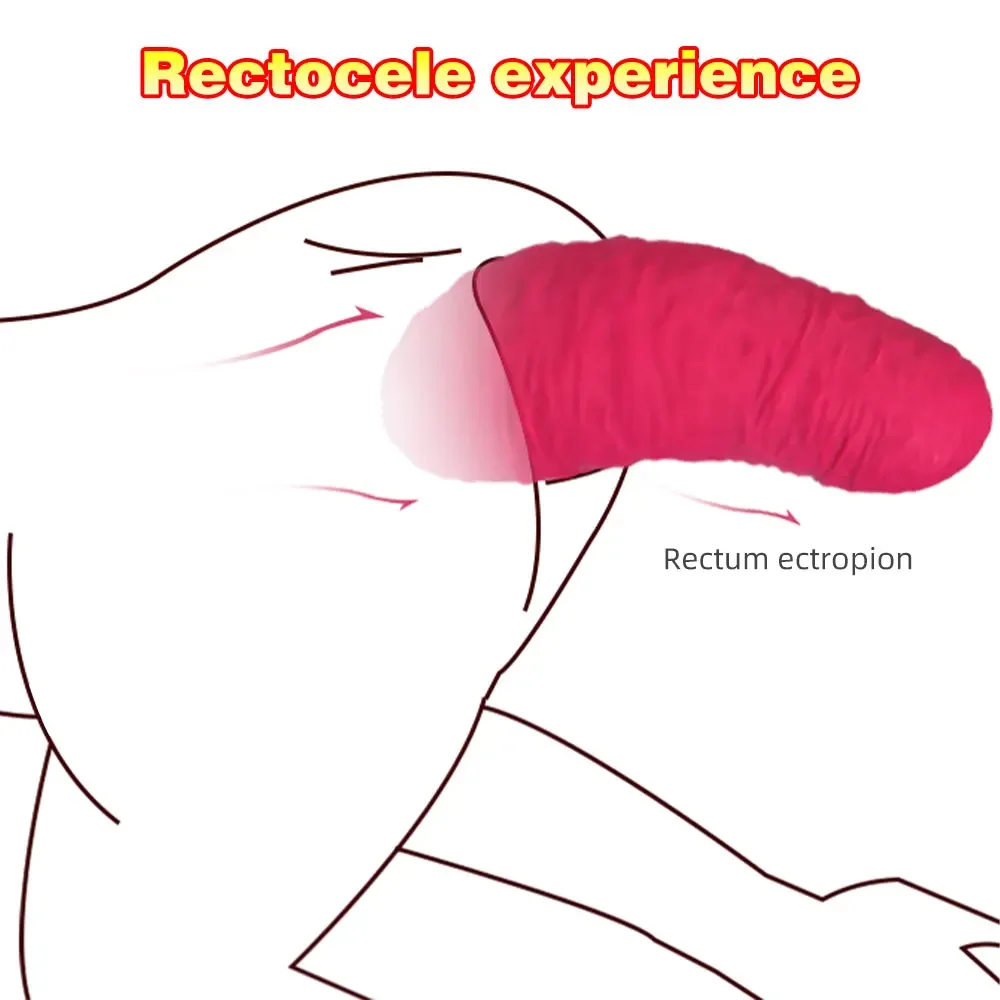 Giant Anal Plug Rectal Wall Modeling Rectocele Experience Human Ovulation Dildo Butt Plug Anal Dilator Sex Toys for Man Woman