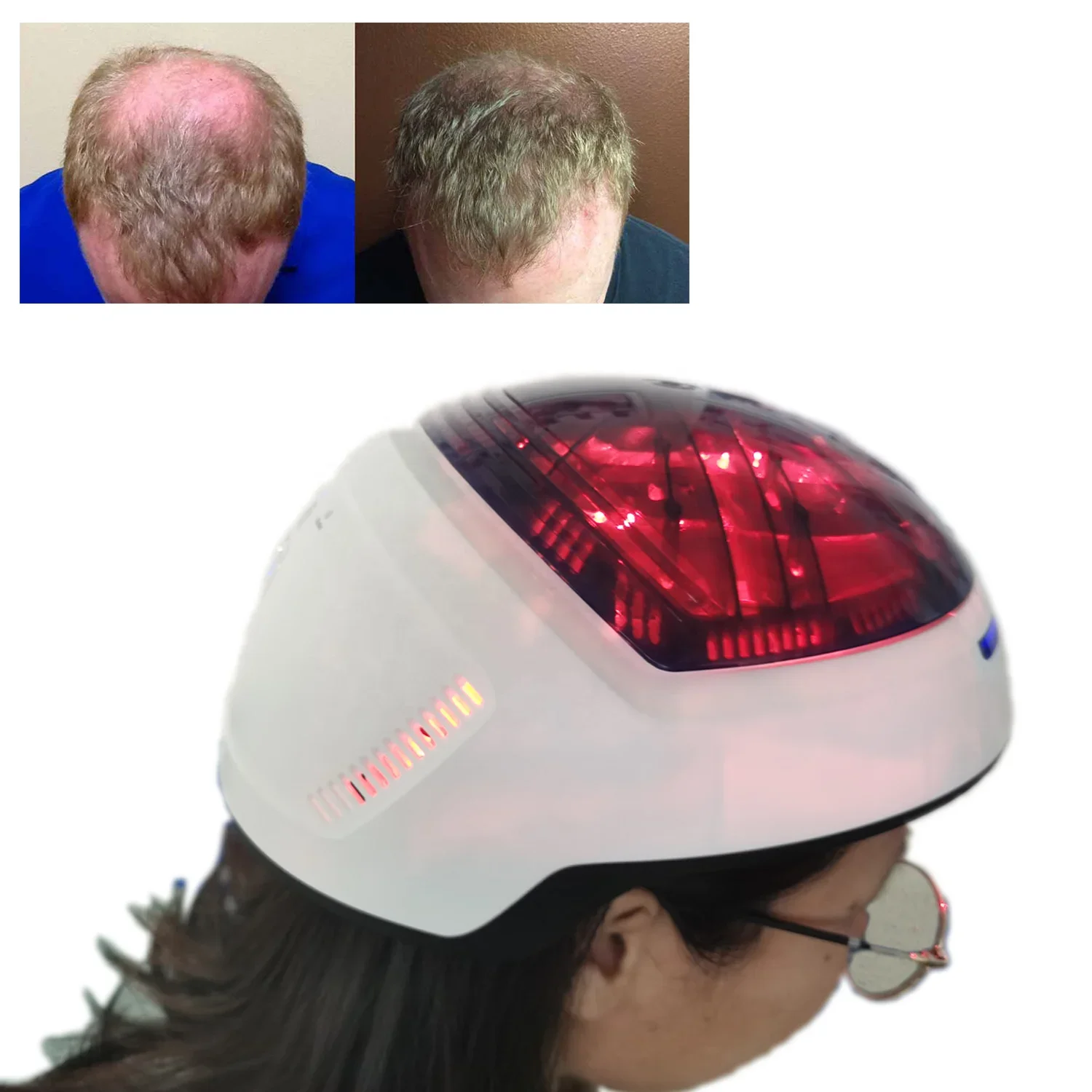 Kernel KN-8000B Hair Growth Laser Cap Device Thinning Hair helmet for Hair Growth