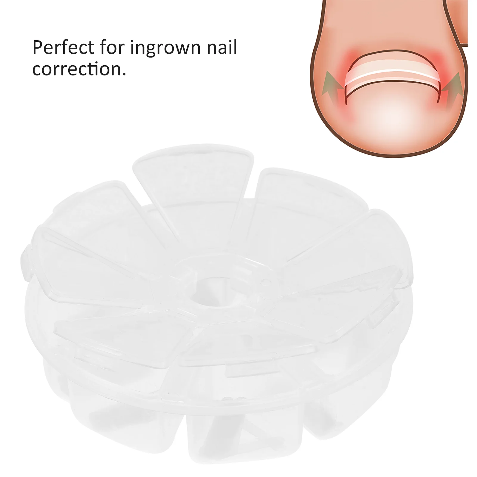 120 pièces orteil Correction des ongles autocollant Patch Paronychia correcteur fichier élastique Patch correcteur ongles Correction Patch