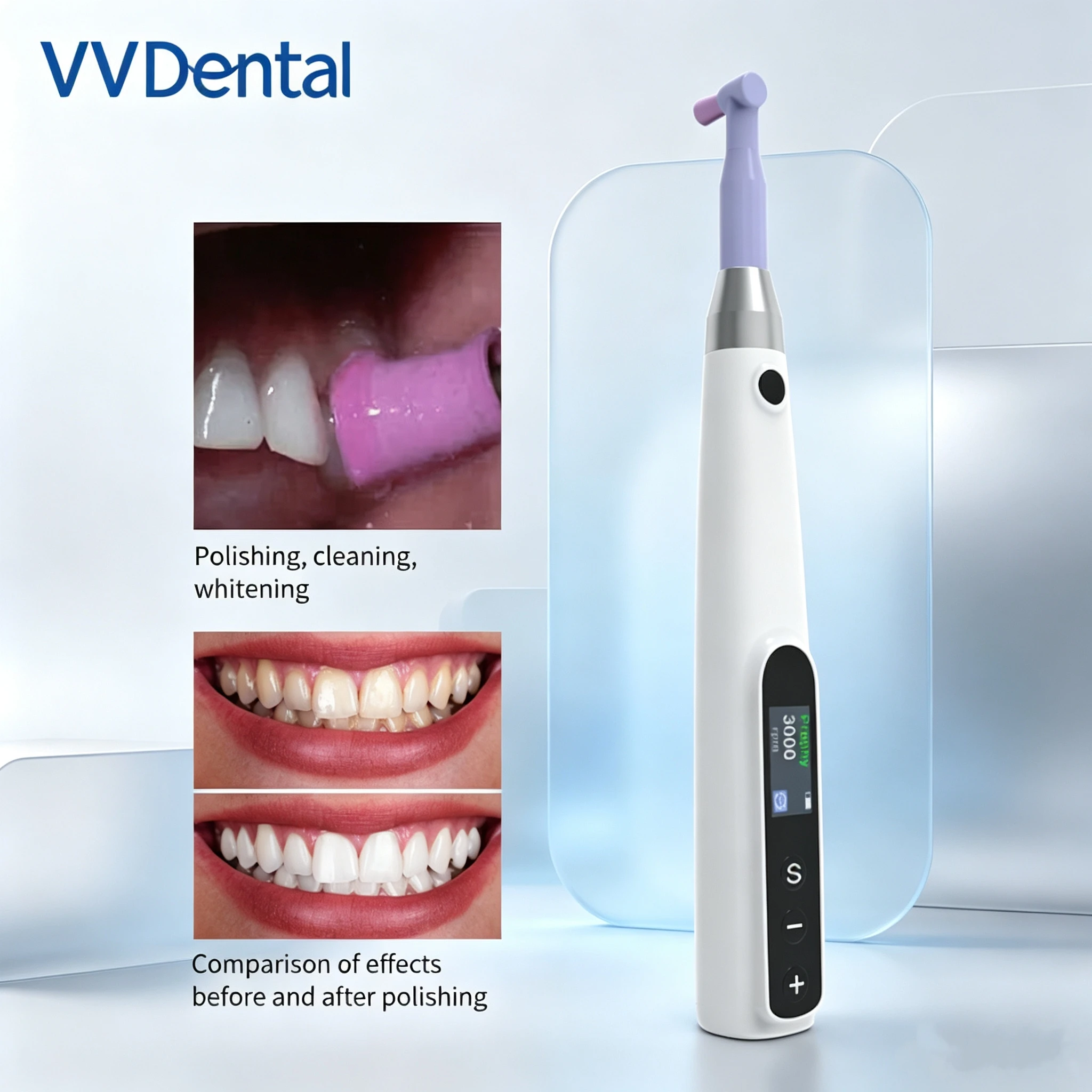 VVDental Polisher Wireless Prophy Motor For Teeth Cleaning And Polishing Dental Polisher Prophy Motor LCD Motor Handpiece 360°