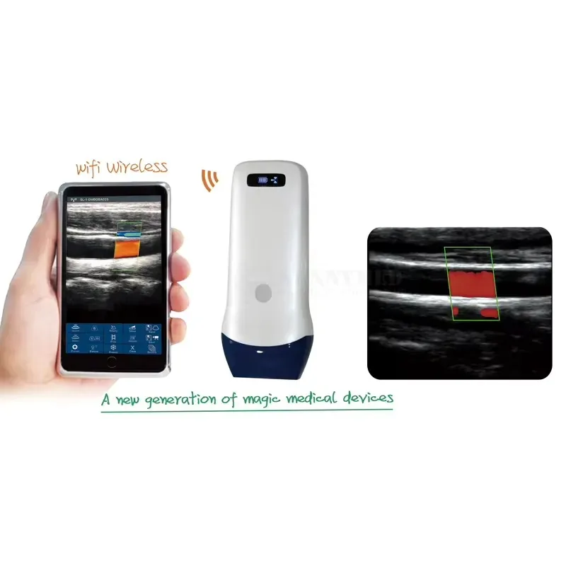 SY-5L PW PDI Line Wireless Probe Machine Linear Probe for Veterinary  Imaging