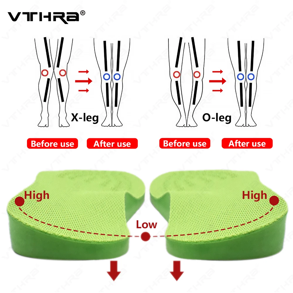 O/X-Leg Orthopedic Insoles Arch Support Insole Corrigibil Bow Legs Valgus Varus Massaging Shoe Pads Beauty Leg Feet Care Insert