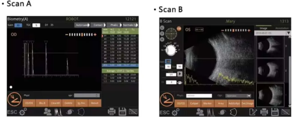 Retiwave 1000 Ophthalmic AB เครื่องสแกนจักษุวิทยา Ultrasound Scanner Eye Diagnostic สําหรับ Eye Clinic