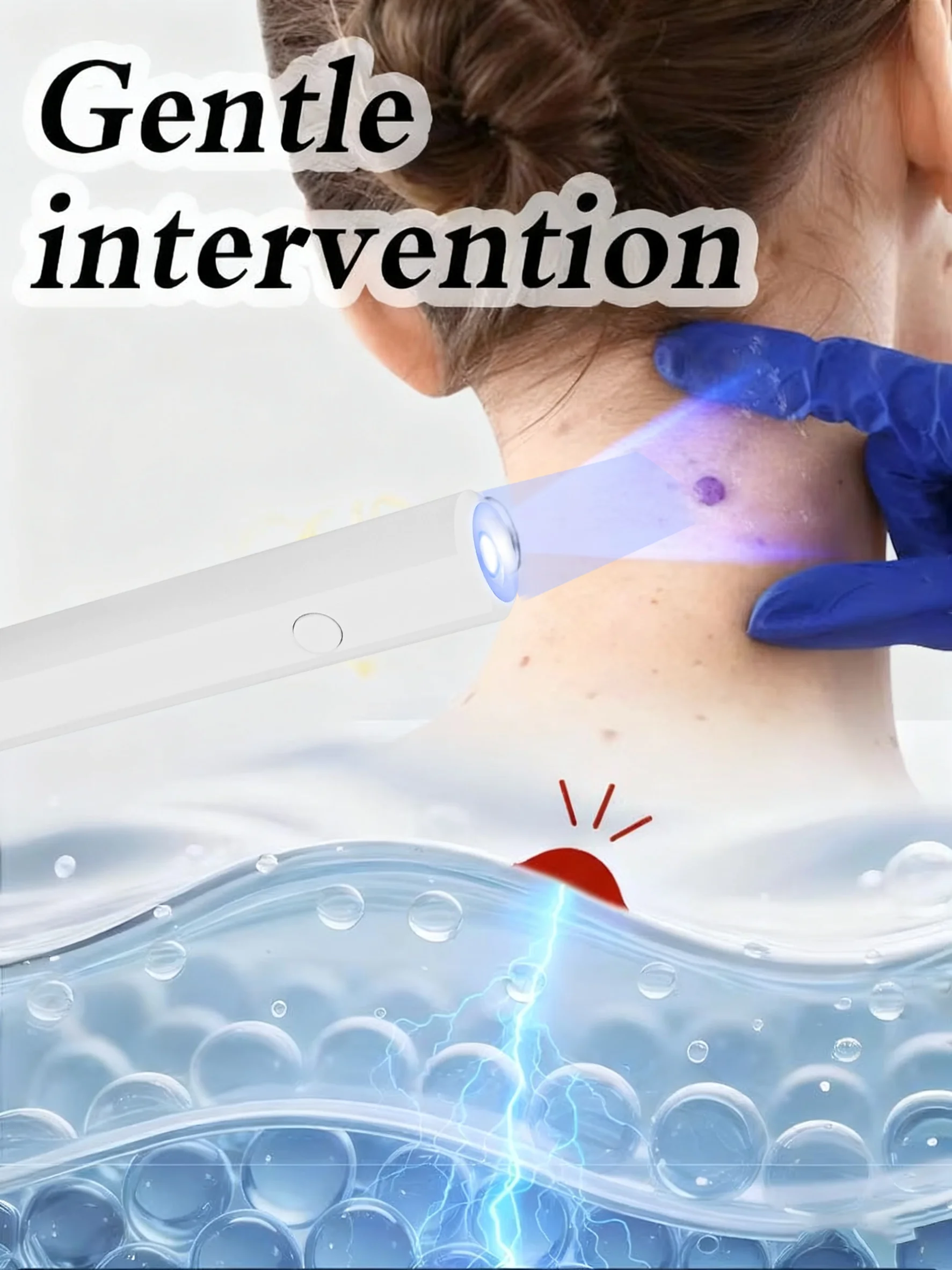 2025, unisex hete verkoop blauwlichtpen, lost wratten op, huidlabelverzorging, draagbaar gereedschap