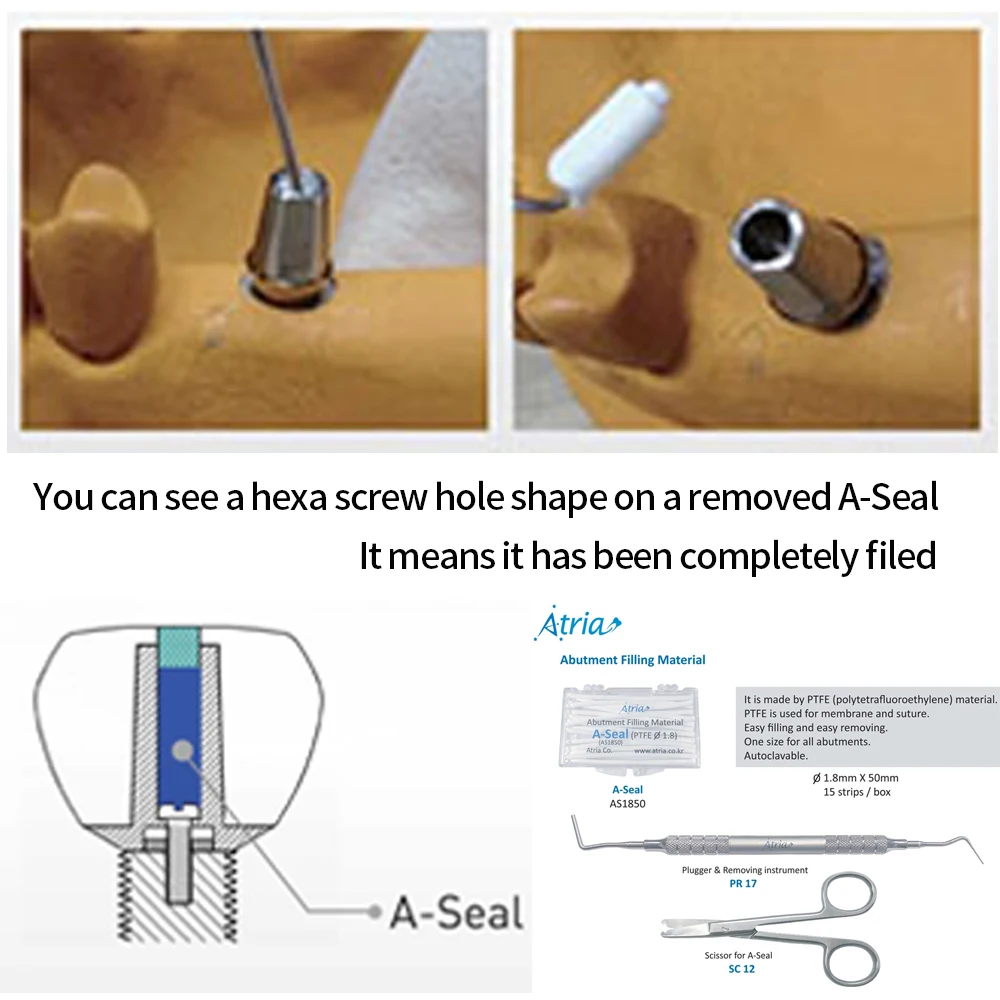 歯科インプラントアバットメント充填材ヘキサネジ穴シーラー歯科用品器具アクセサリーヘキサントアトリア A シール