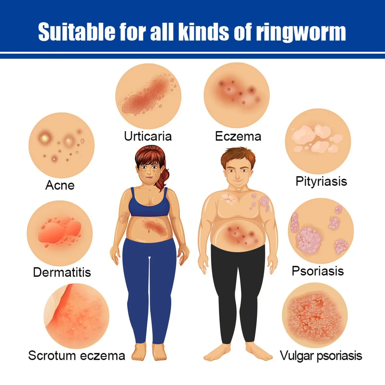 Strumento per fototerapia ultravioletta da 311 nm utilizza la lampada UVB UV per vitiligine, psoriasi, macchie bianche, malattie della pelle