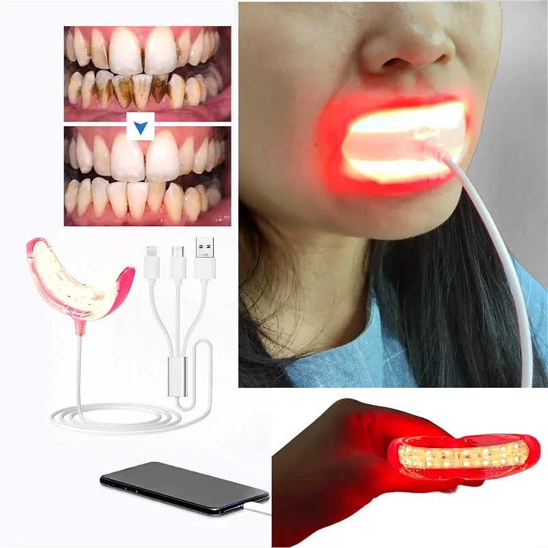 Red Light Therapy Device for Oral Health Immediate Relief of Tooth Pain and Sensitive Gums