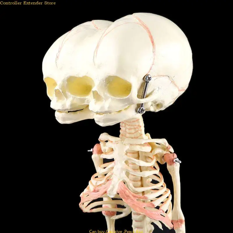 

Human Baby Deformed for Head Skull Research Model Skeleton Anatomical Anatomy Teaching Study Display