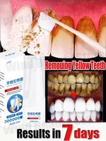Dental Calculus Remover Teeth Whitening Spray Toothpaste Cleaning Oral Hygiene Removal Halitosis Plaque Stains Fresh Breath Care