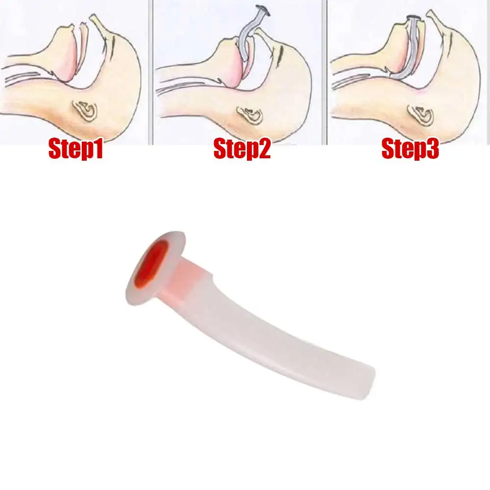 Wholesale Mixed Airway Tube Gas Guide Tube For Patients Disposable Oral Air Way White Color Coded Airway Tube For First Aid - Image 6