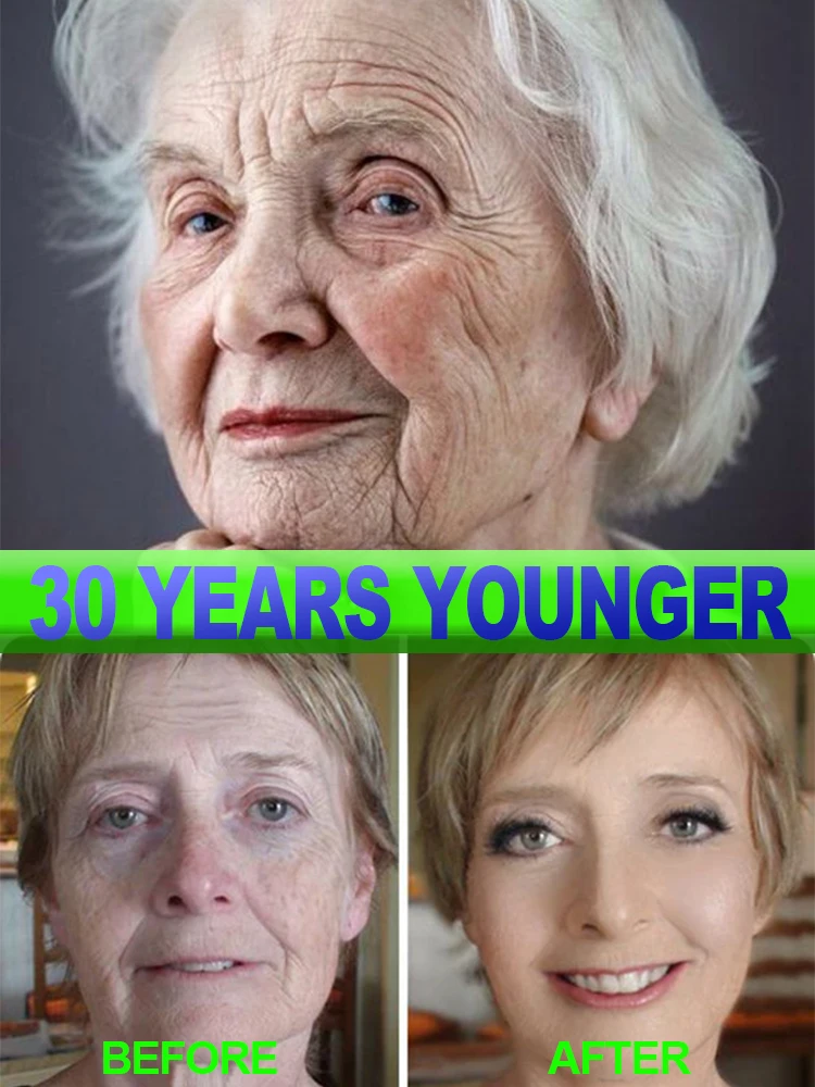 

Wrinkles disappear Become beautiful now