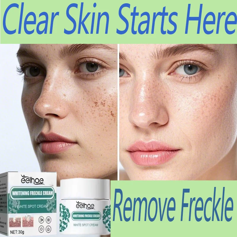 

Removal Dark Spots Whitening Freckle Cream Leaving skin looking brighter clearer and more luminous prevent future discoloration