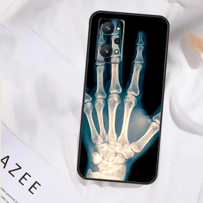 حافظة فنية هيكل عظمي لهاتف Realme 14 13 12 11 15 Pro Plus GT6 GT7 Pro C55 C51 C35 C33 C61 C65 C67 C63 C71 C75