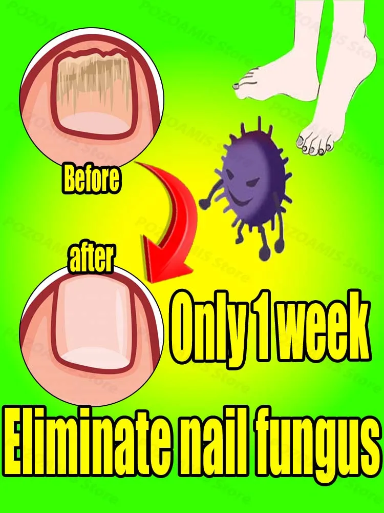 

Формула быстро впитывающая восстанавливает обесцвечивание, скорлукость и повреждение.