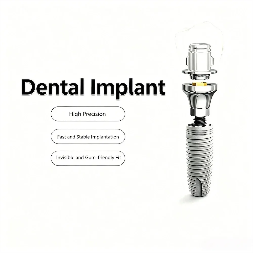 Dental Implant, Oral Implant Screw, Implant Analog & Accessories - Complete Sizes, Fine Craftsmanship for Dental Use