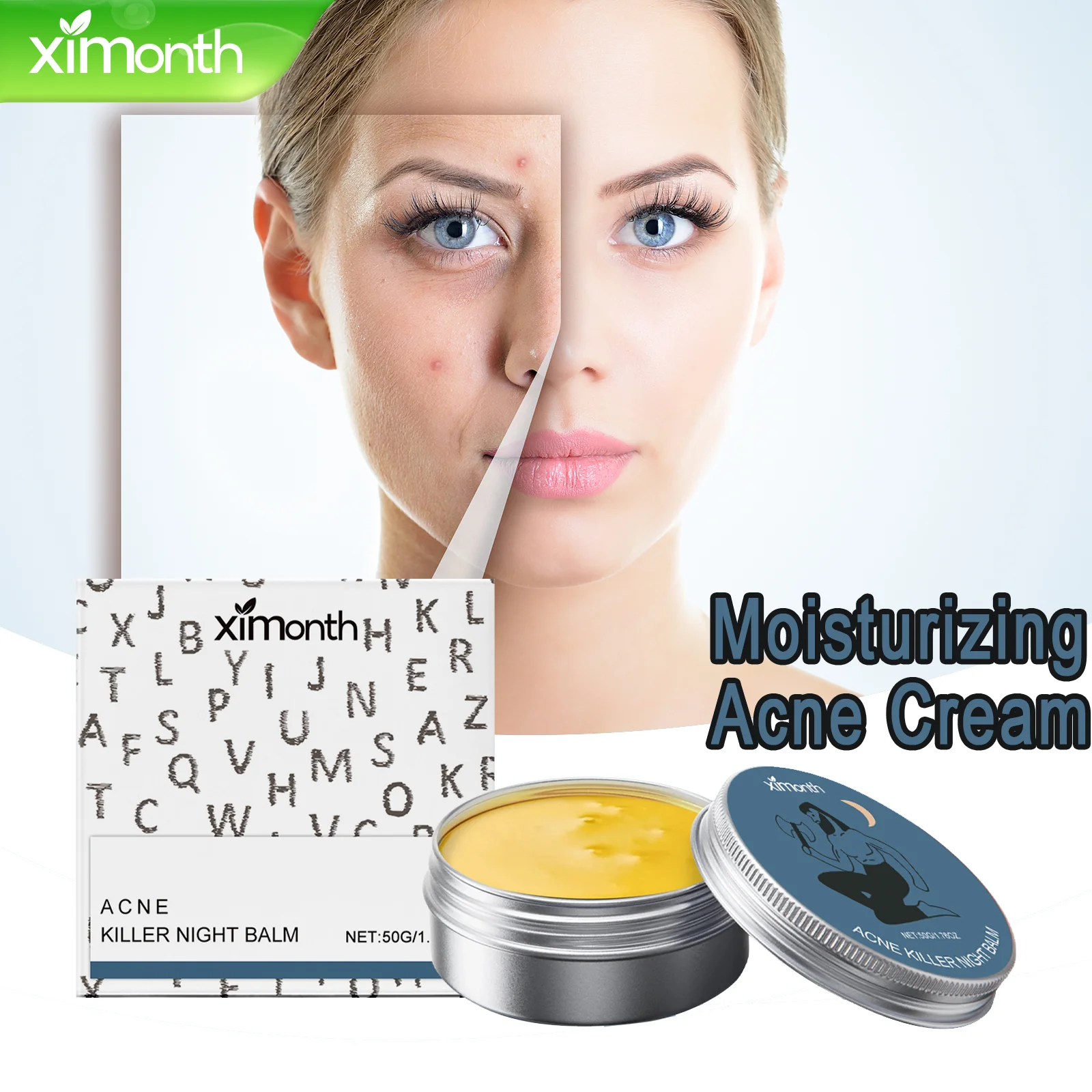 Crema hidratante para el acné, 50g, para el tratamiento facial, sin aceite, cuidado de la piel propenso del acné, vitamina E y caléndula, absorción rápida, no graso