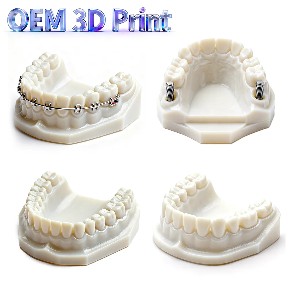 3D Printed Dental R…