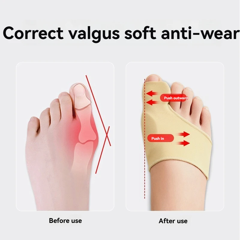 Рисунок 2 - Разделитель пальцев ног