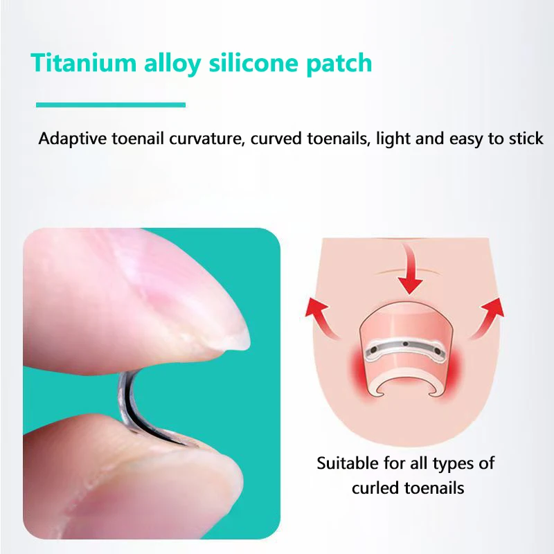 【2Pcs Ingrown Toenail Corrector Tools Pedicure Recover Embed Toe Nail Professional Ingrown Toenail Straightening Clip Brace】