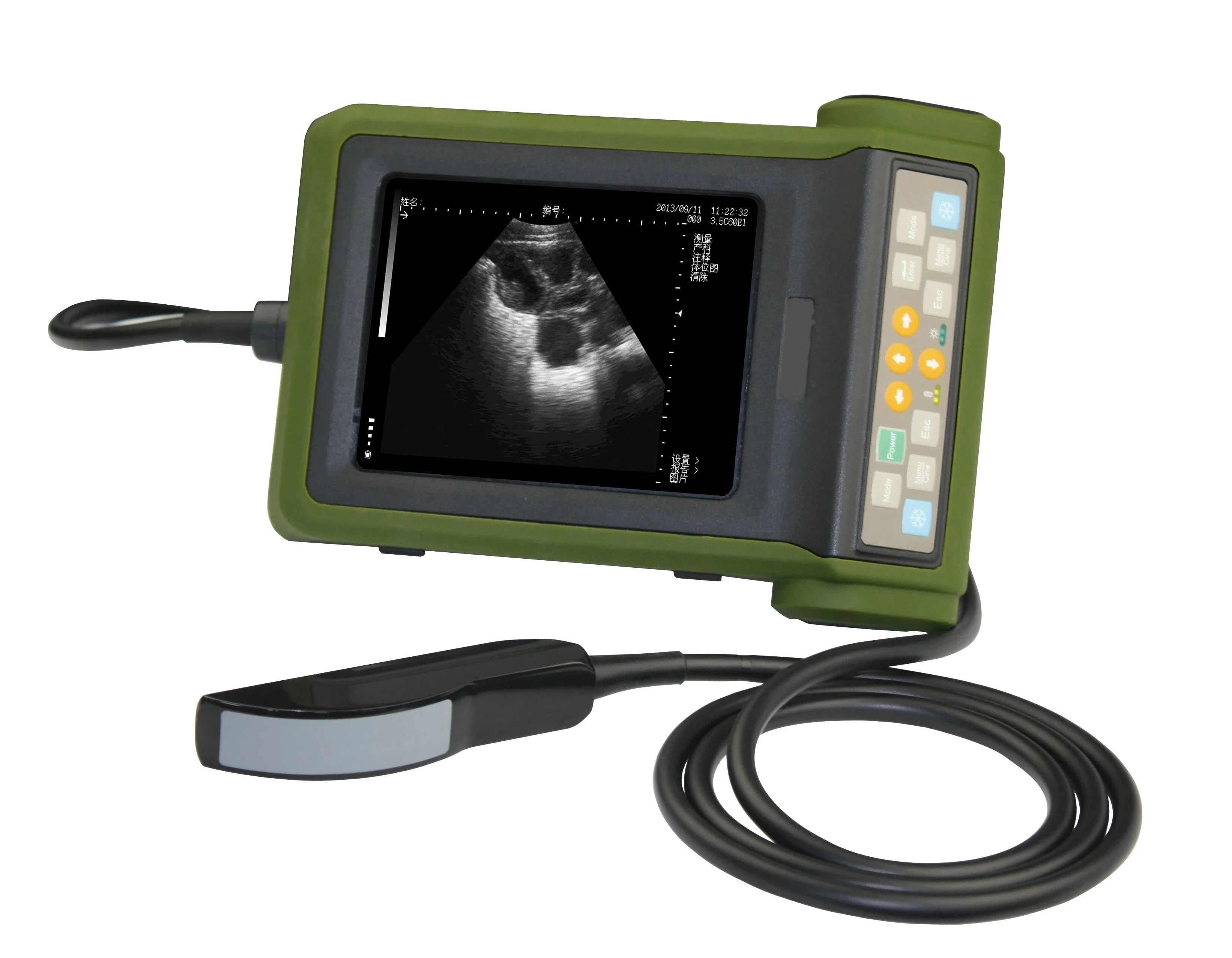 Portable Ultrasound Scanner for Outdoor Use Animal Portable Ultrasound Machine Price