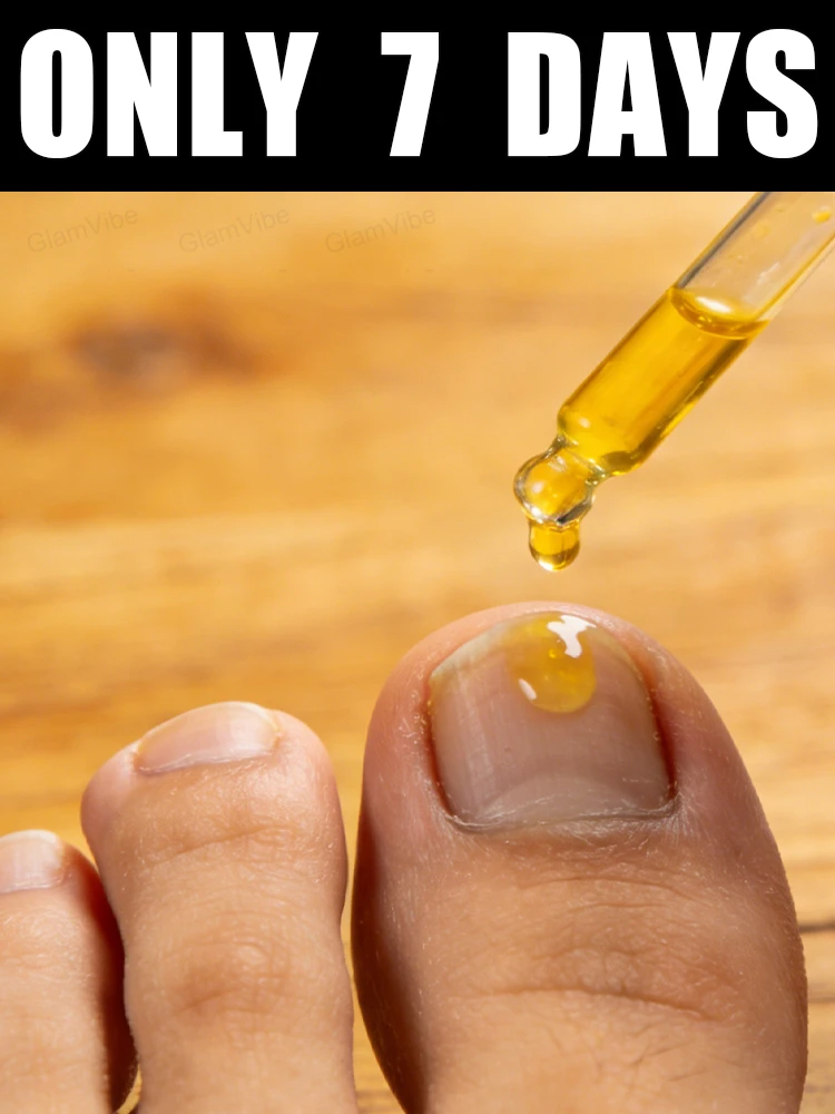 

Great news! Free shipping in 2026! Nail care solution, 10ml