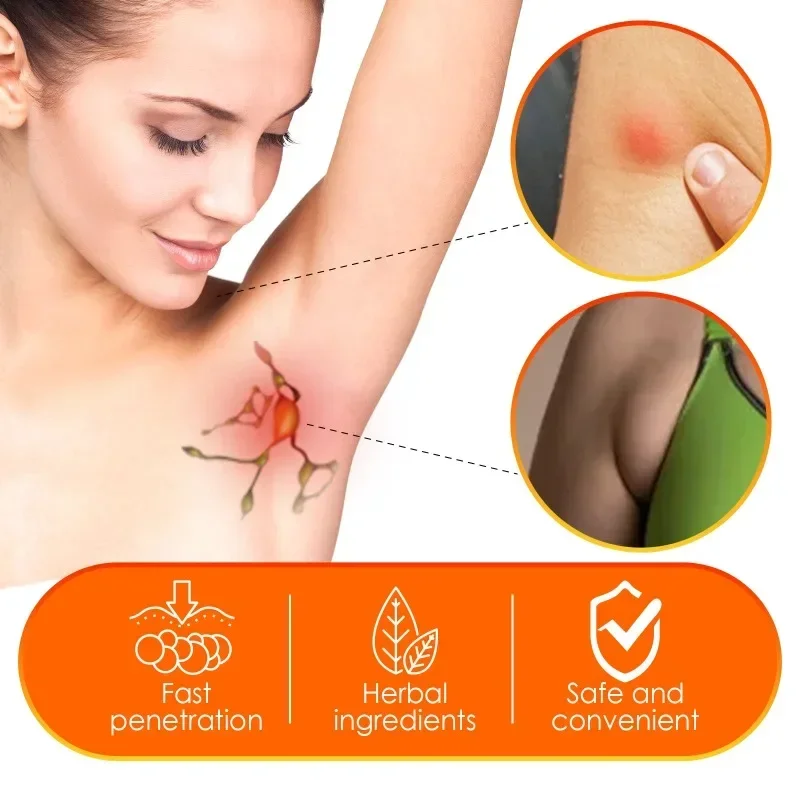 Lymphatic Detox Cream Lymph Ointment Neck Anti-Swelling Cream Treatment Breast Armpit Lymph Nodes Medical Plaster Health Care