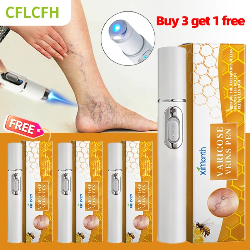 

4Pcs Varicose Veins Pen Laser Therapy Improves Moderate Varicose Vein Improve Blood Circulation Relieve Leg Pain For Men Women