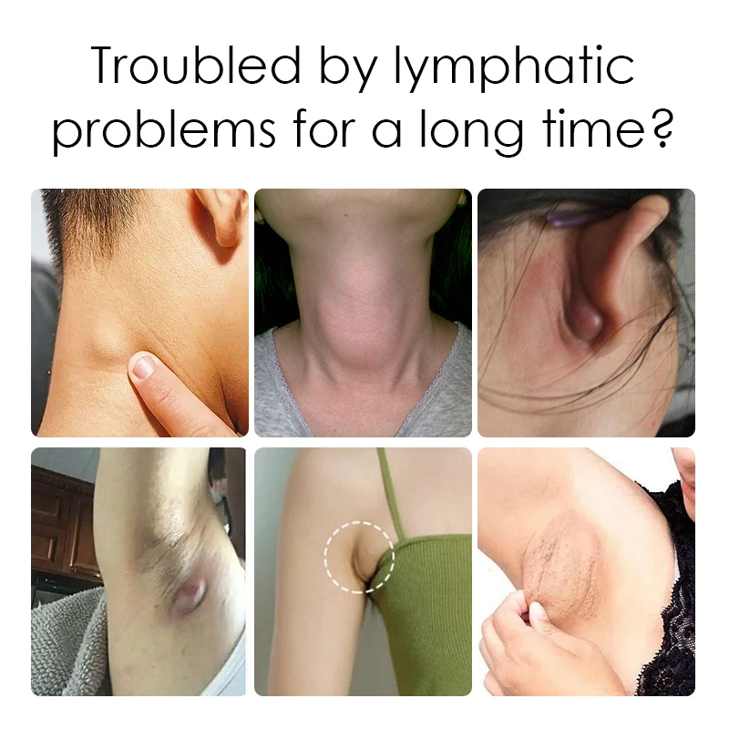 12pcs=1bag Lymph Swelling Relief Plaster Lymphatic Detoxification Transdermal Patch Lymph Node Stickers Health Care Unisex H142