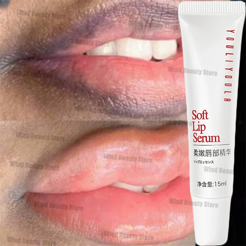 Serum bibir merah muda pencerah cepat, masker bibir pelembap bibir Gloss penghilang asap gelap, pemutih permanen