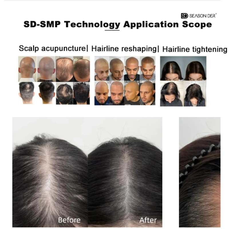 Thumbnail 3 - #8 Latest PMU Machines Offers