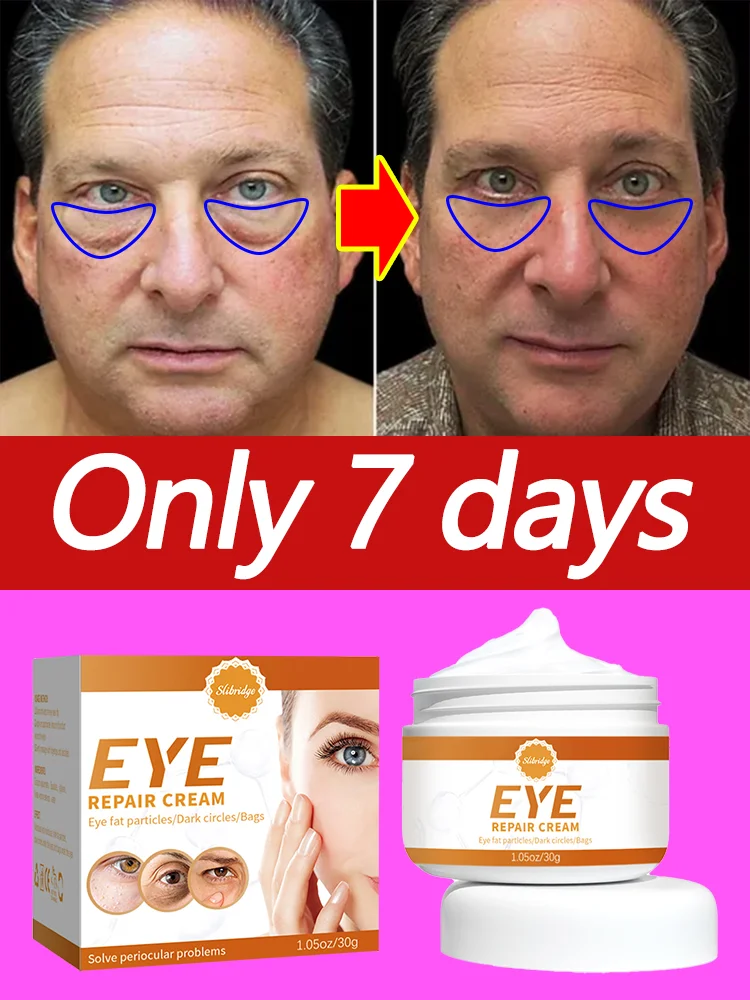 

Eye Cream for Puffy Eyes