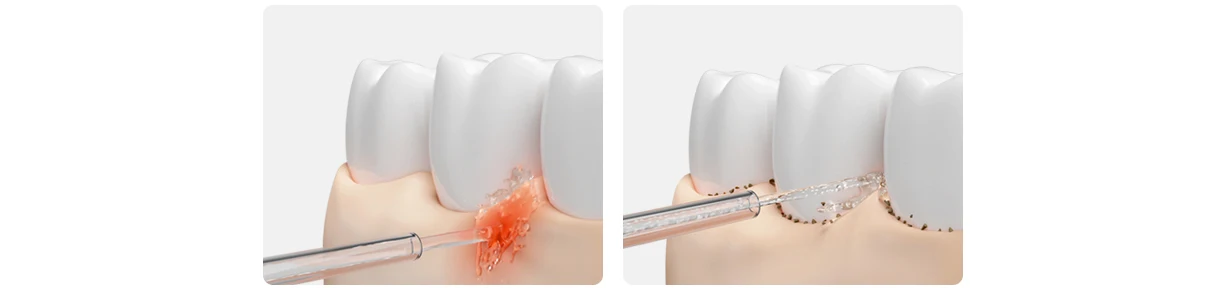 MIJIA Electric Oral Irrigator 2 – Ultrasonic, 3 Modes, 200mL Tank, 2-Min Auto-Off,90-Day Gentle Use,Water Flosser Dental