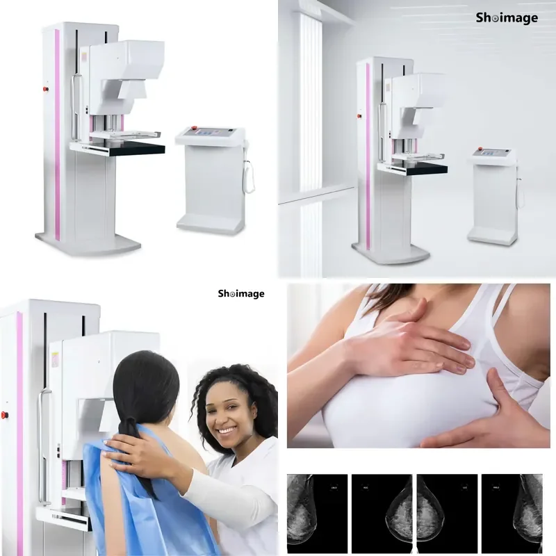 6KW 200MA Digital Medical Equipment Radiography United Imaging Mammogram X-ray Machine
