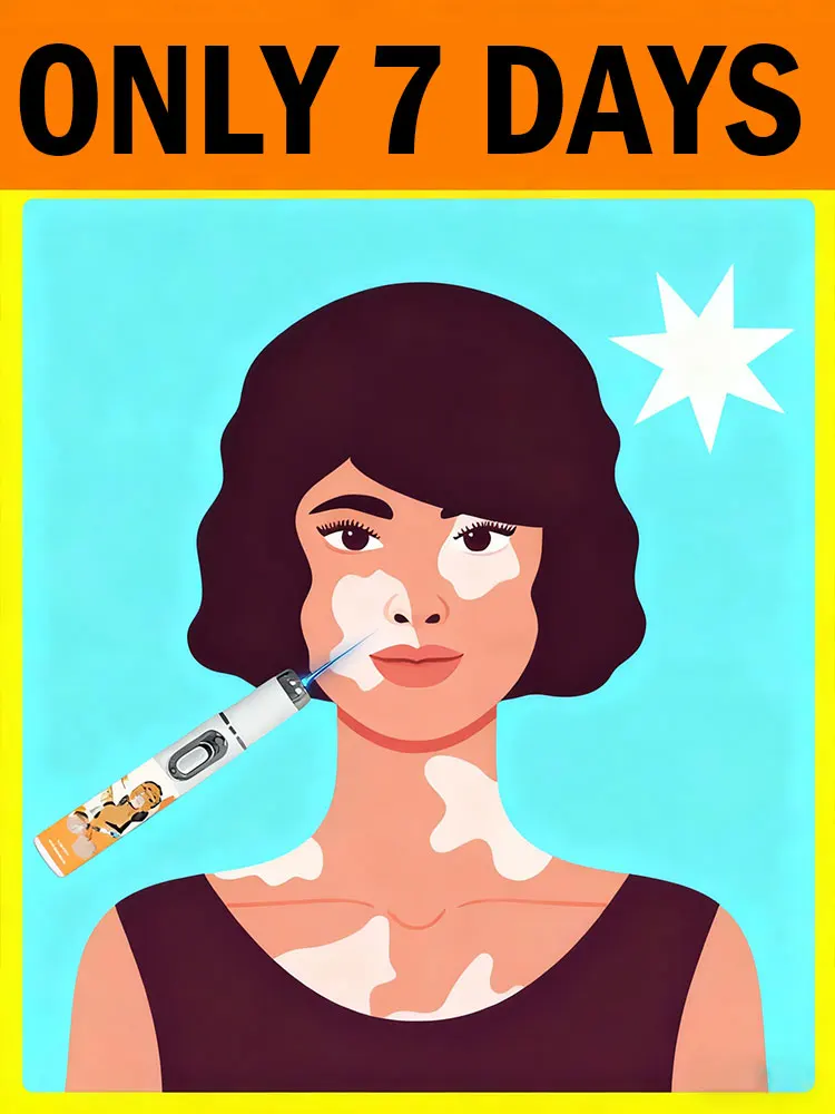 Dice addio al vitíligo en 7 días