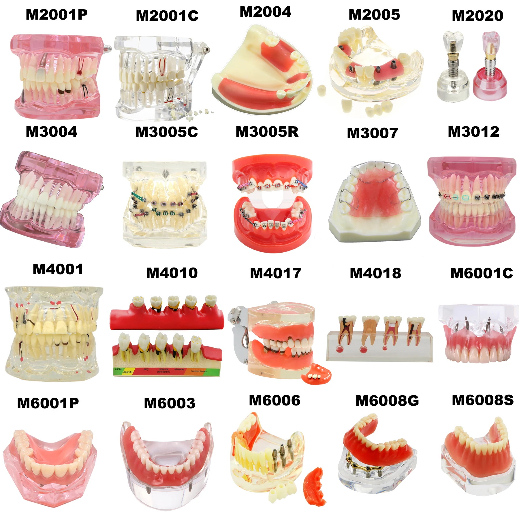 Modello di denti dentali modelli di insegnamento dentale modello di impianto dentale rimovibile modello di odontoiatria denti per l\'allenamento