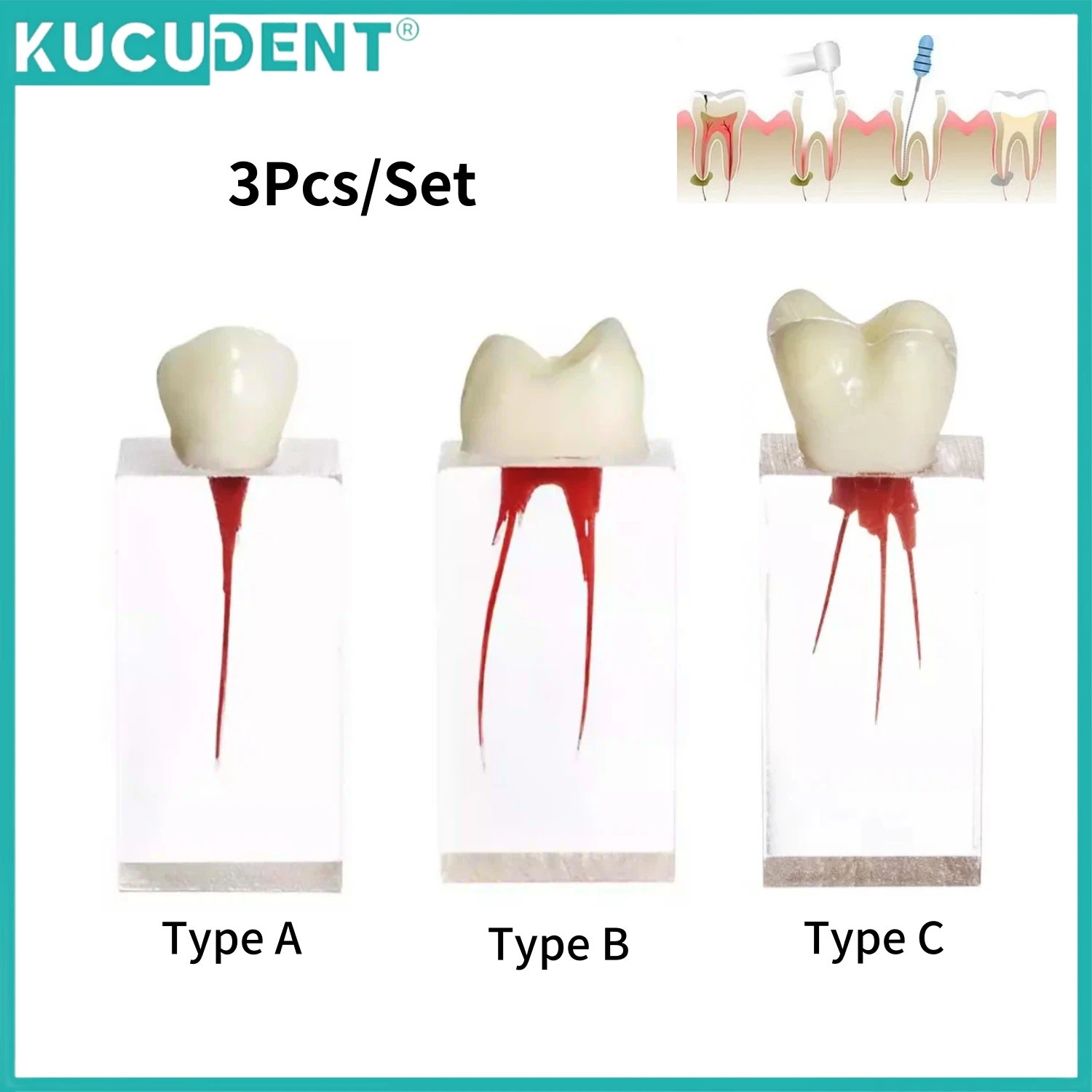 

Dental Teaching Model Endodontic Treatment Teeth Model Endo Root Canal Block RCT Practice Resin Model Study Training Pulp Cavity
