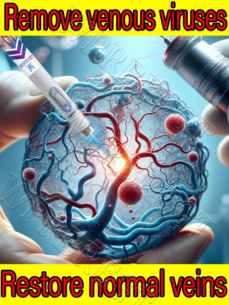 

A new generation of treatment for vasculitis, phlebitis, spider leg pain relief, varicose veins pain-free