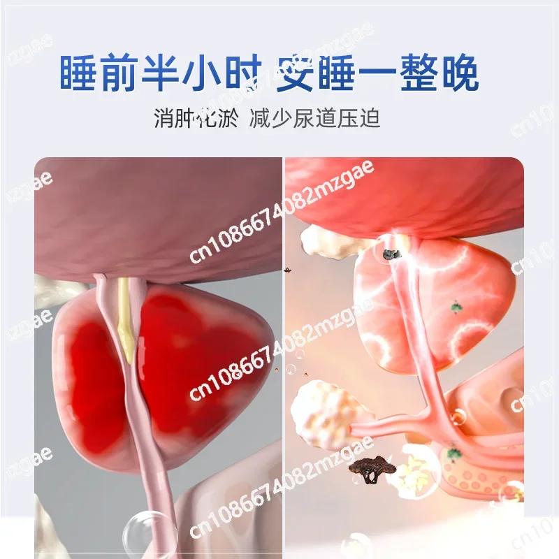 Prostate treatment device, home use,traditional Chinese medicine, chronic inflammation,urinary system,acute male massage therapy